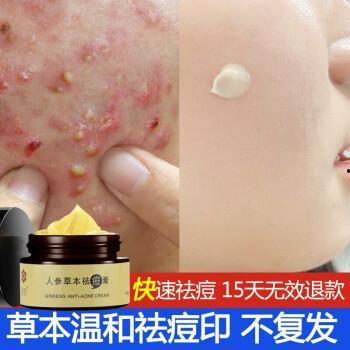 耳朵里黑头视频