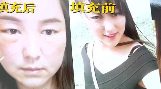 整容院视频,真实手术过程与术后效果大揭秘